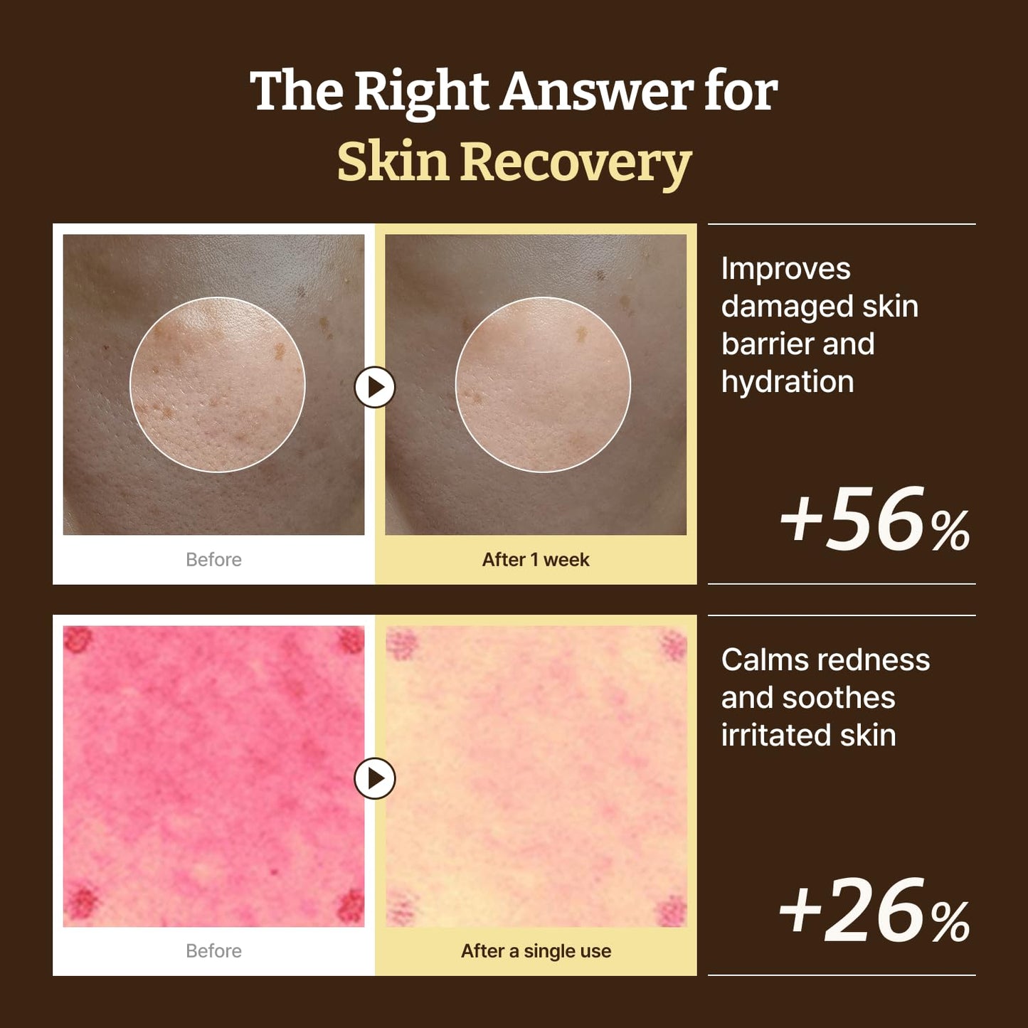 [麗珠蘭PDRN醫美平替] Dr. Reju-All Advanced PDRN Repair Cream 高濃度麗珠蘭修復霜 20ml ‧ 術後修護、保濕舒緩 細節圖 3