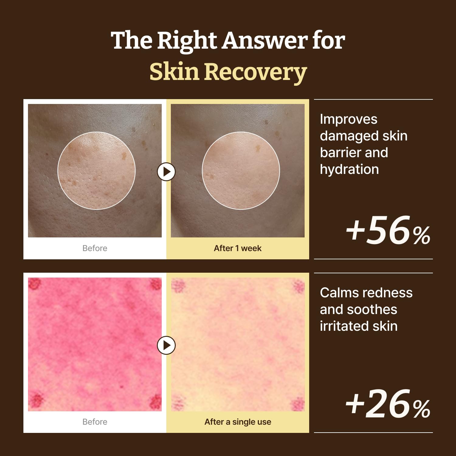 [麗珠蘭PDRN醫美平替] Dr. Reju-All Advanced PDRN Repair Cream 高濃度麗珠蘭修復霜 20ml ‧ 術後修護、保濕舒緩 細節圖 3