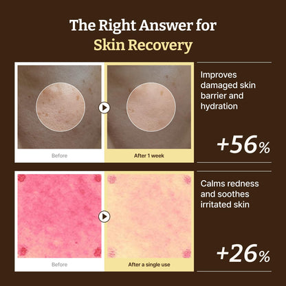 [麗珠蘭PDRN醫美平替] Dr. Reju-All Advanced PDRN Repair Cream 高濃度麗珠蘭修復霜 20ml ‧ 術後修護、保濕舒緩 細節圖 3