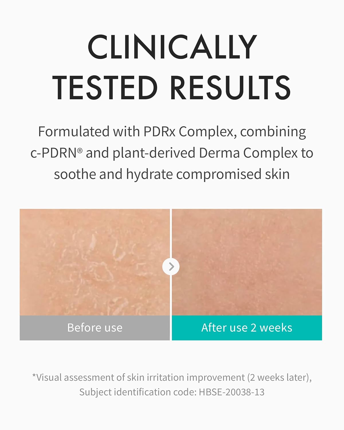 [乾燥脫皮修護首選] REJURAN Moisturizer c-PDRN 修復保濕乳液 40ml·敏感肌適用 細節圖 3